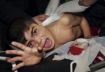 Gaza cast lead photo shows small boy wounded and in agony from US sponsored Israeli weapons.