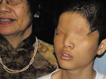 Agent Orange is not just a plague in Vietnam.