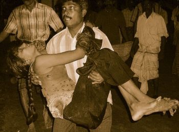 Tamil girl injured during Sri Lanka Genocide