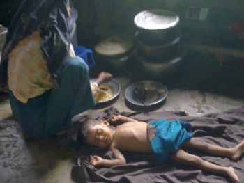 Rohingya people like this little boy are sick and suffering and the government is doing little to help in Burma.  Photo from Arakan state first published by Salem-News.com