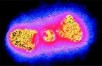 Rabies virus 